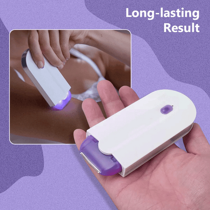 Lighteme Laser-Epilierer – Schmerzfreie und dauerhafte Ergebnisse
