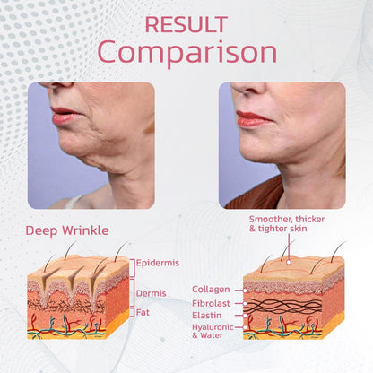 Appareil de beauté Lighteme - Nettoyez votre système lymphatique