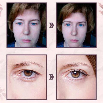 Lighteme Augenlid-Aufkleber inkl. GRATIS-Pinzette | Beseitigen Sie hängende Augenlider in Sekunden 