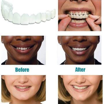It is DESIGNED to look like a NATURAL SET OF TEETH.